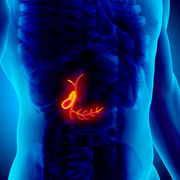 Colecistectomía por laparoscopía